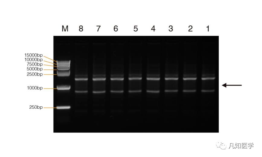 rna含量多实验数据肝组织1肝组织2肾组织3肾组织41%琼脂糖凝胶电泳