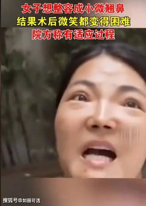 整形女演员自曝隆鼻失败！隆鼻这条路，如何有效的避坑?