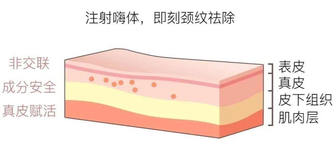 同伴不是自己不优秀，都是同伴太耀眼，聊聊水光针家族的“沧海遗珠”——嗨体2.5