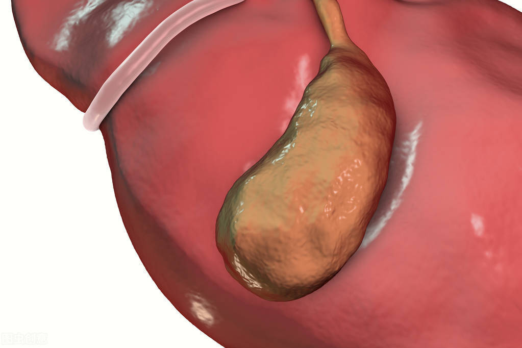 治疗|胆囊炎都有哪些症状？其诱因有哪些？如何治疗？医生告诉你