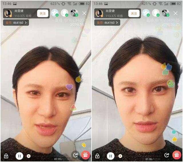下巴明星的N种“假下巴”，尖到戳死人，翘成老巫婆，一个比一个怪异