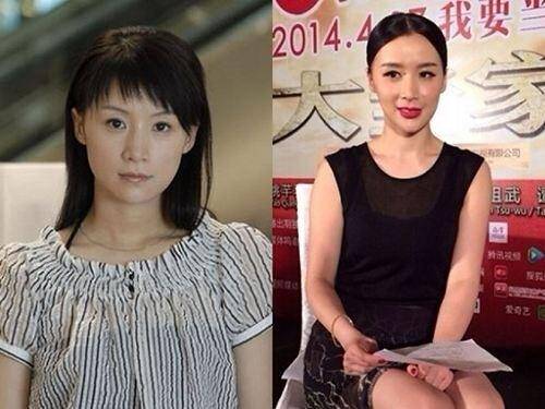下巴明星的N种“假下巴”，尖到戳死人，翘成老巫婆，一个比一个怪异