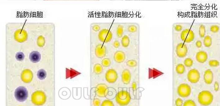 三个阶段脂肪填充一次可以成功吗?脂肪填充图片效果好,来看看