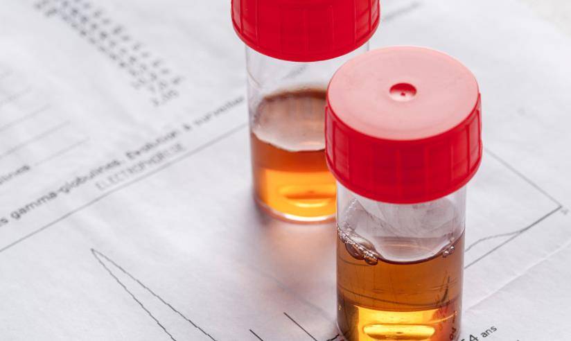 进行|男性每天排尿次数接近“这个数”就偷乐吧，尿毒症可能还离你较远