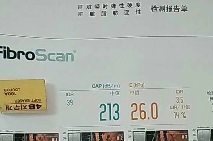 肝脏|小三阳十几年，发展为肝硬化，还能治好吗？这3位医生说了大实话