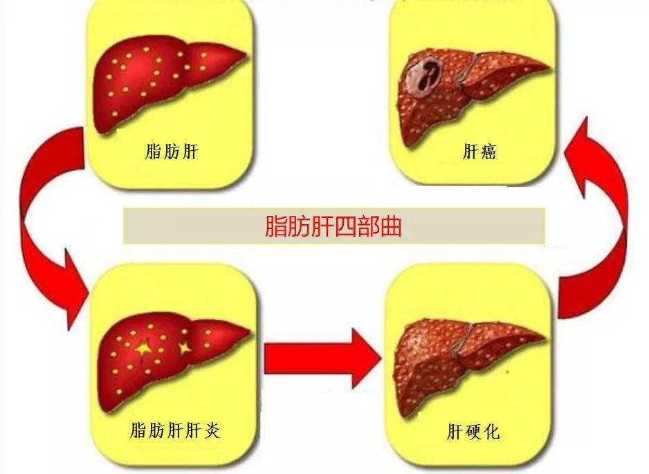 肝不好的人,遠離