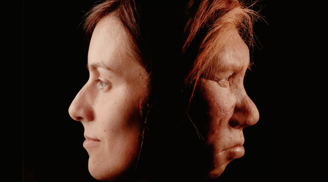 夜猫子抑郁症皮肤过敏可能有尼安德特人血统