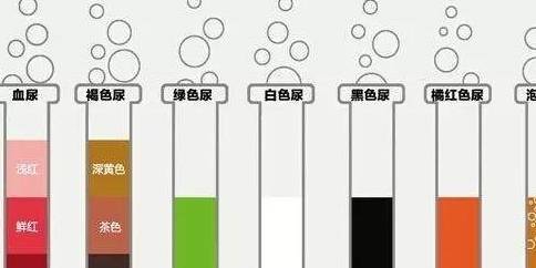 肾脏|长期泡沫尿，并且潜血+++，怎么办？小克告诉你