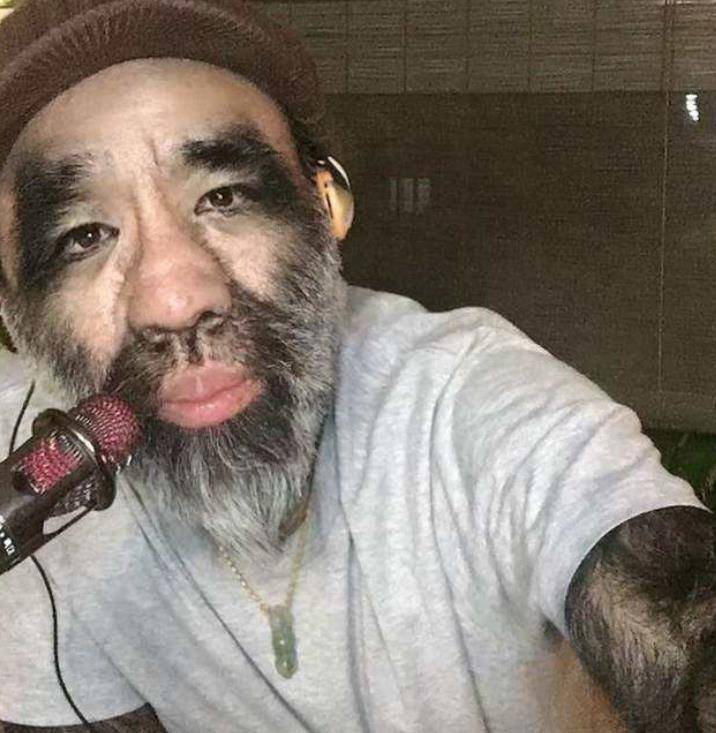 原创毛孩于震寰因浑身是毛经历数次爱情伤痛41岁娶90后娇妻