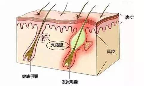 废物经常盐蒸，打造你的细腻皮肤。