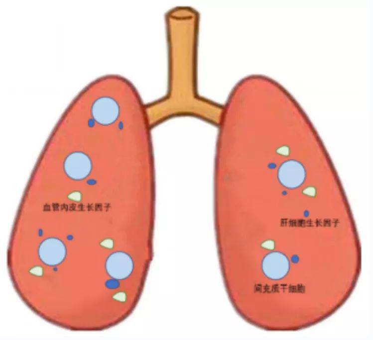 治疗|一文读懂：间充质干细胞治疗慢阻肺的原理