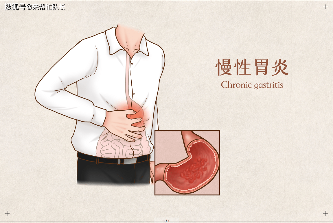 什么情况需要做胃切除 f6a98aa340c2431798d9f831f3aa81f2.png