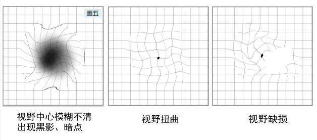 阿姆斯勒表格图片