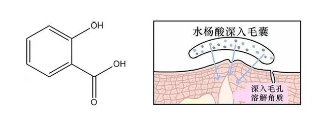 酸类揭秘 | 水杨酸护肤品老品牌Stridex施颜适的故事