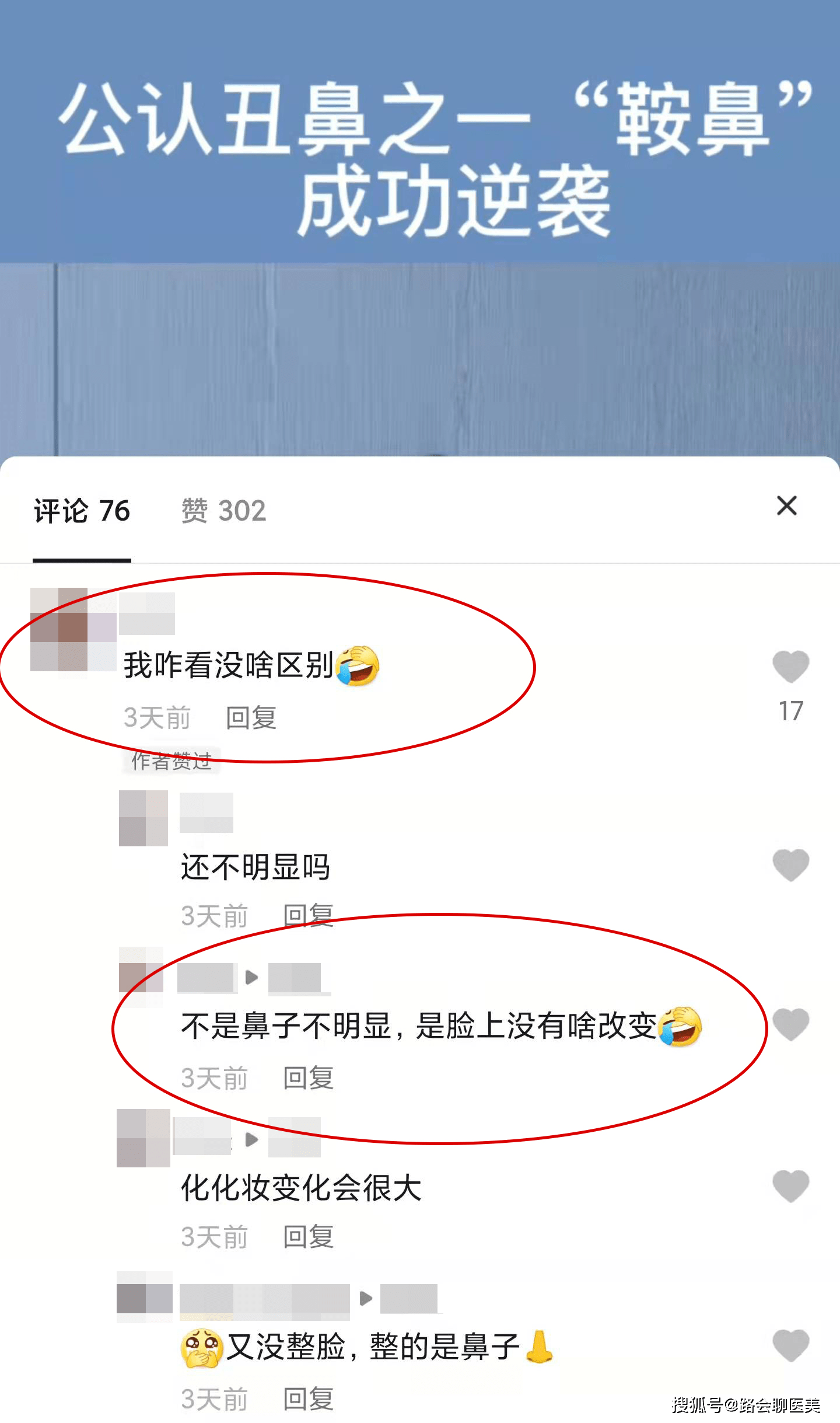 整形为什么我看到鼻整形效果，都是换了一张脸？