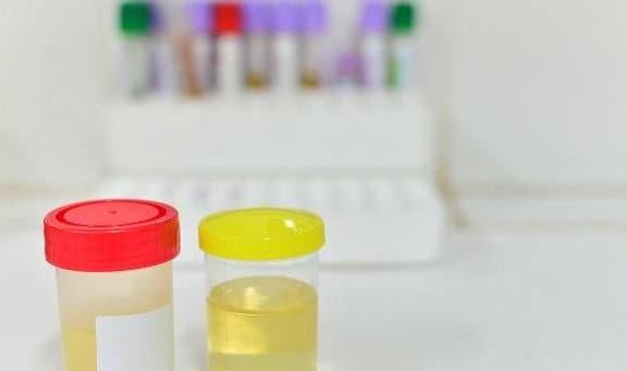 症状|肝病来“敲门”时,身体可能会亮起4个“红灯”,早知道早受益