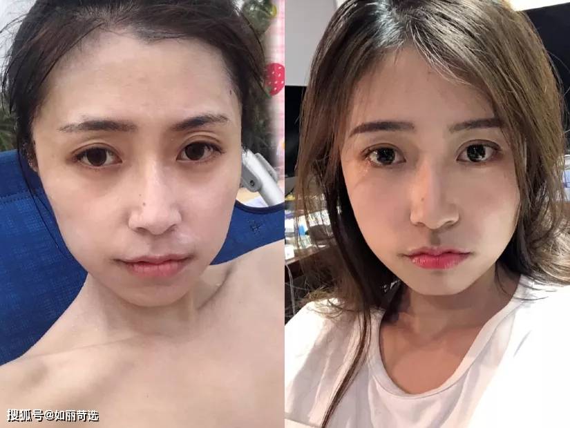 玛吉明星都在做的热玛吉？不推荐你做，理由只有一个（不是贵）