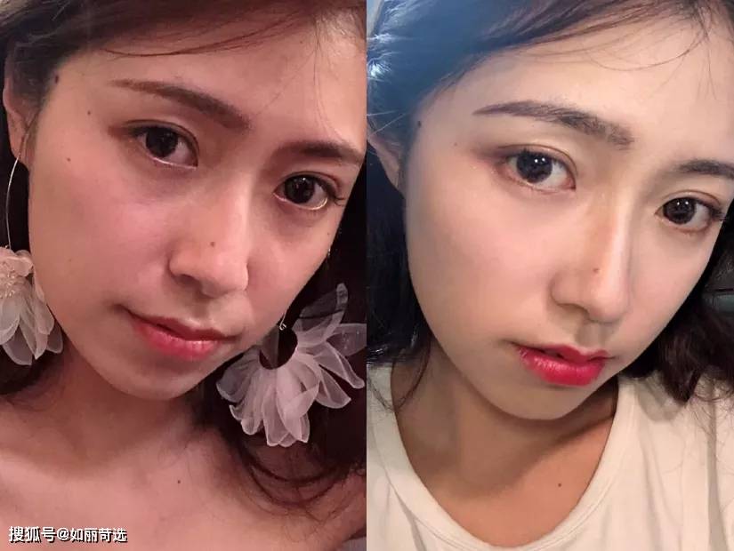 玛吉明星都在做的热玛吉？不推荐你做，理由只有一个（不是贵）