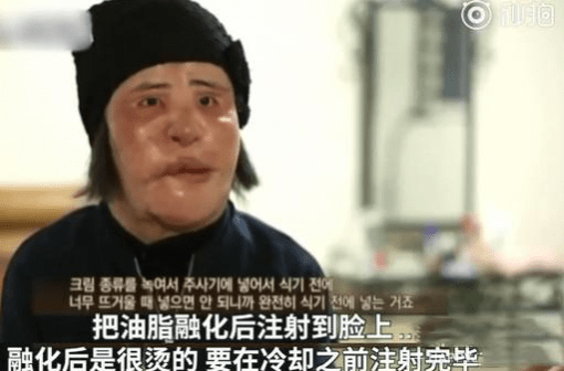 美貌整容狂人韩慧景：昔日美貌如花，整容后事业全毁，57岁遗憾离世