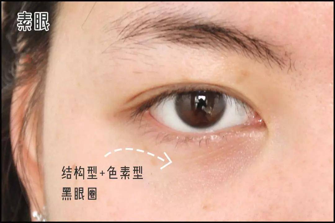 血管3种超实用遮黑眼圈大法，手残党一看就懂！