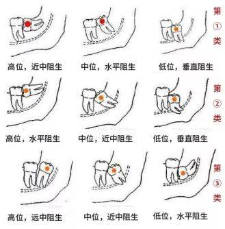 153a3c94e2b74817a8f1ad8a140b4972.jpeg