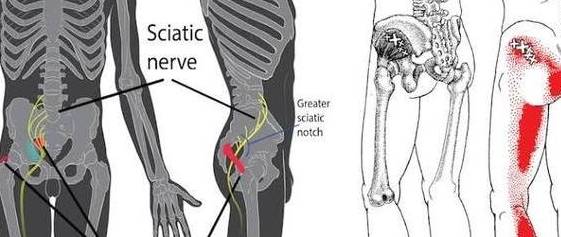 啥叫逆骨 803999c23597411196e6ca801e03a996.jpeg