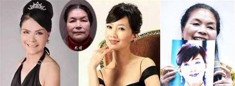 女神63岁大妈臆想成为赵雅芝，“整容”十几次，真实原因令网友泪目