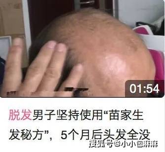 毛囊|论当代老母亲脱发原因，最后一个扎透了心