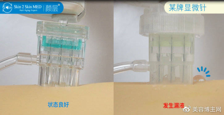 药液水光福音,颜层水晶针轻松应对水光难题