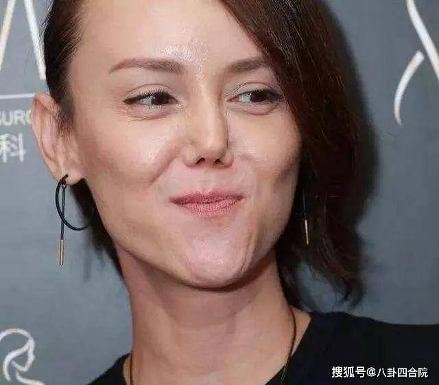 李小璐明星“假鼻子”大PK，帅哥变丑男，美女变女巫，谁越整越残？