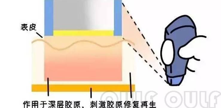 玛吉解疑：做一次热玛吉价格是多少？美容项目热玛吉价格多少？内幕来了~