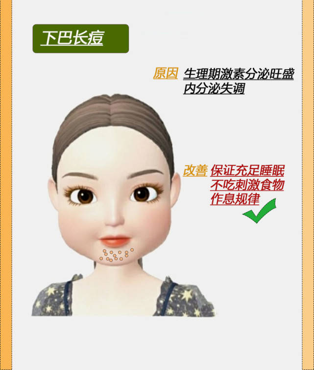 脸部脸部不同位置的痘痘解析，如何改善呢？