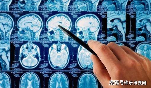 玩手机的大脑和不玩手机的大脑 ec664d2c88e74a74857930953ec2f474.jpeg