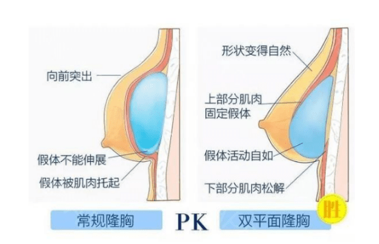 胸部美丽性感的胸部曲线如何拥有，来试试这个方法吧！