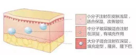 分子医美科普 | 一次玻尿酸美容后，需要持续打吗？