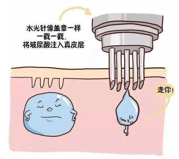 治疗美肤医师郭金月：想要皮肤水嫩，该选择光子嫩肤还是水光？