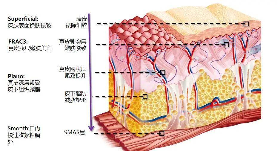 美容|Fotona4D美容 云南铜雀台杨才华讲解Fotona 4D Pro