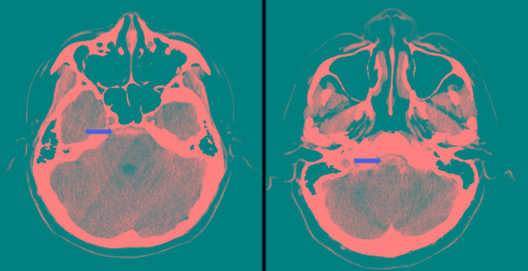 友谊医院线上挂号CT加急-北京友谊医院做ct预约多久 