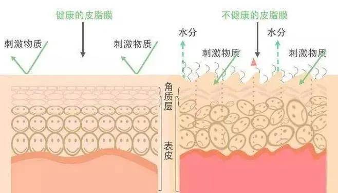 护肤品从护肤到轻医美，敏感肌到底该怎么做？