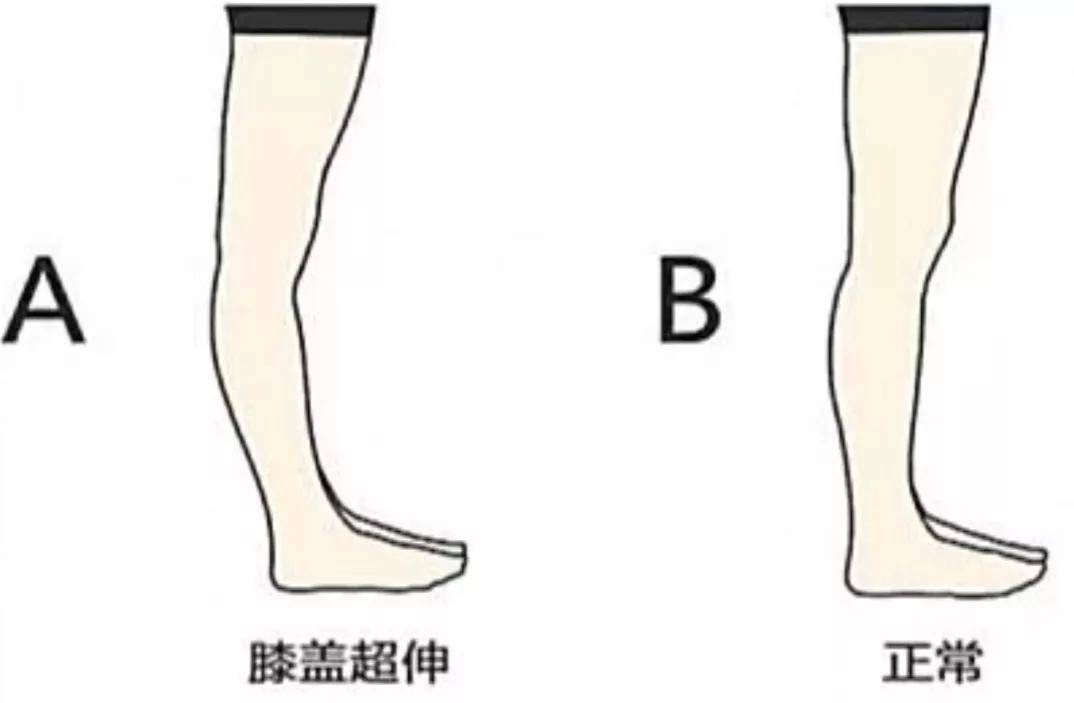 方法成为腿精其实也是有方法的！