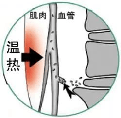 护考必背100篇--热疗法篇_皮肤_热水袋_病人