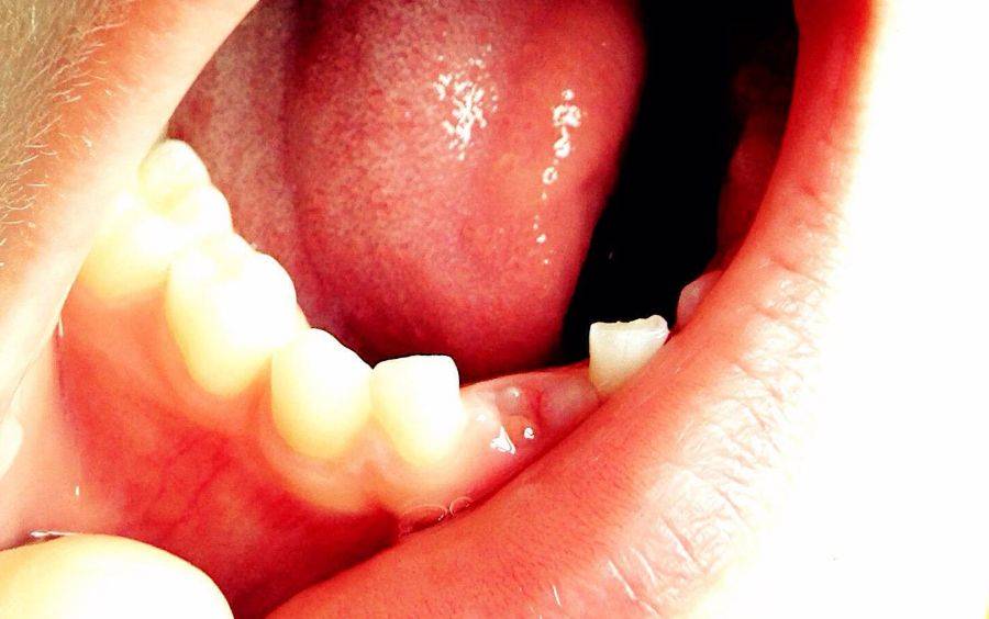 c9a480d1b9e5427c8115d31135330330.jpeg