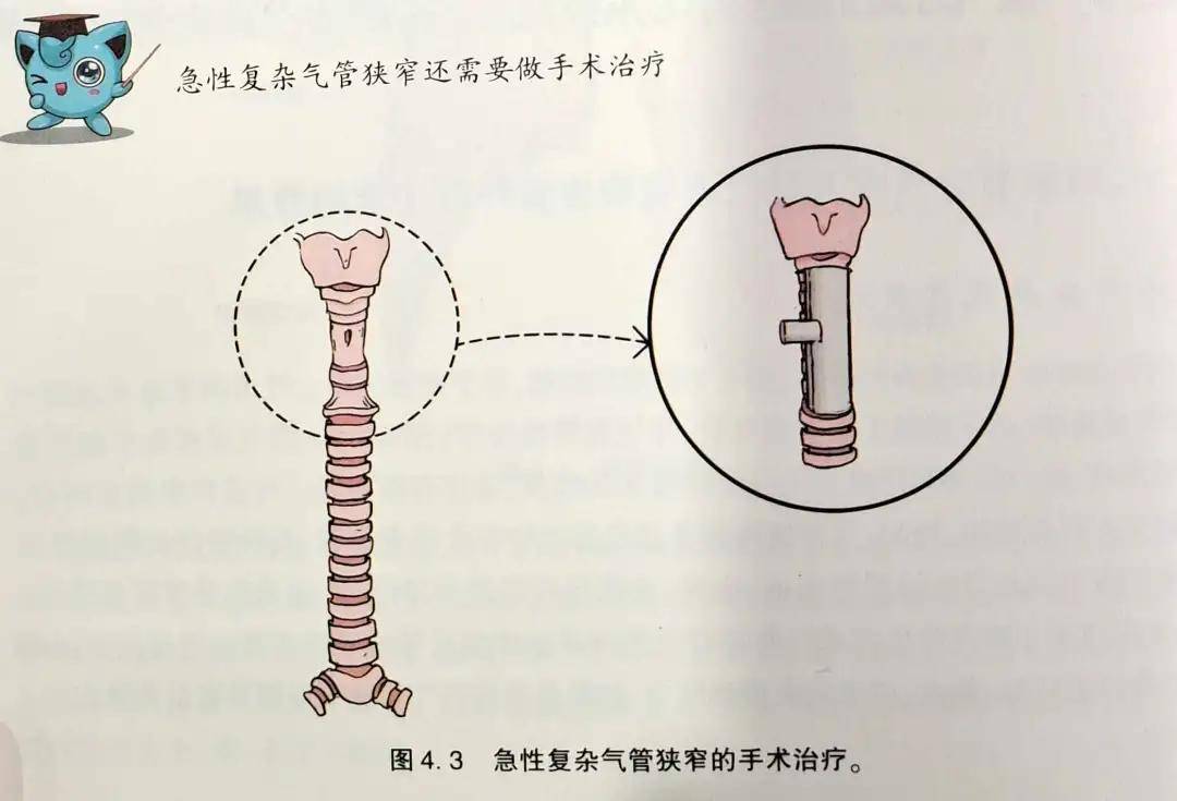 氢气的用途和使用方法 56e452539b4d4155ad172f12a9b1614c.jpeg
