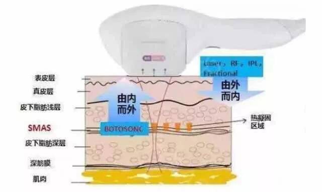 操作天啊~做完超声刀脸上有疙瘩是咋回事？是触犯了做完超声刀的禁忌吗？