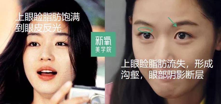 来判断根据眼眶结构来判断和修正自己的眼部光影美感