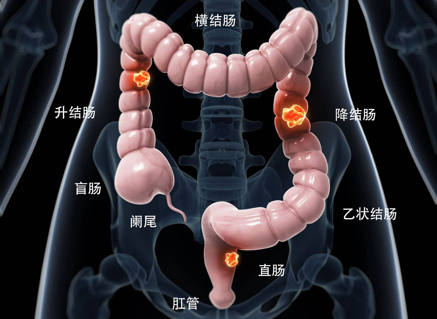 原创一天拉肚子10多次出血腹泻少不了溃疡性结肠炎这些症状别忽视
