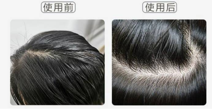 洗头过来人警告！怀孕了还在乱囤洗发水？不怕洗成大油田就继续用吧
