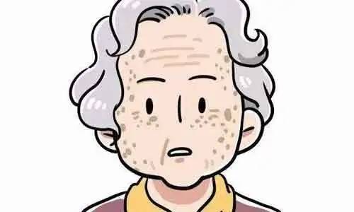 治疗最全色斑护理方案，贝颜美容告诉你要这样护理