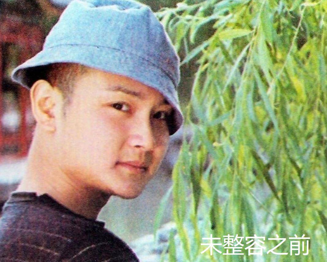 下巴明星频翻车医美需谨慎！有人脸变充气气球，有人下巴变天气预报