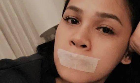 这位印尼女歌手睡前为什么要封住嘴巴?原因竟然是